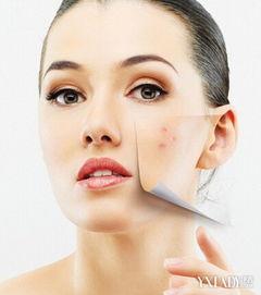 成人痘痘治疗对比视频