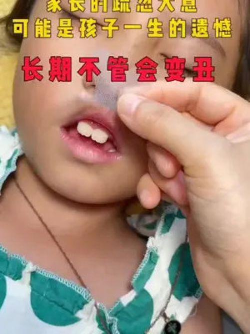 成人张嘴睡觉神器视频,张嘴神器助你轻松呼吸