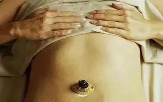 成人便秘可以艾灸吗视频,视频教程详解