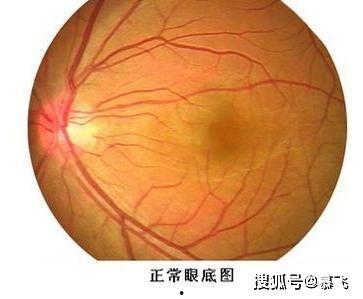 成人眼底检查视频教程,全面解析眼底检查技巧与要点