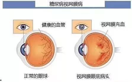 成人眼底检查视频教程,全面解析眼底检查技巧与要点